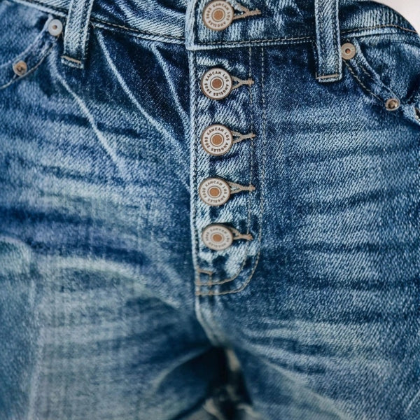 The Venice Button-Fly Denim Shorts